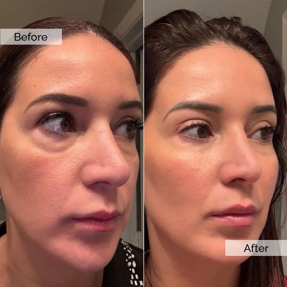 Before and after skincare result