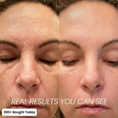⚡50% OFF⚡Tumessa® All In One Collagen Skin Care Wrinkles Treatment Balm