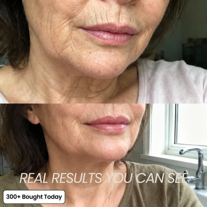 ⚡50% OFF⚡Tumessa® All In One Collagen Skin Care Wrinkles Treatment Balm