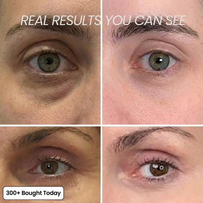 ⚡50% OFF⚡Tumessa® All In One Collagen Skin Care Wrinkles Treatment Balm